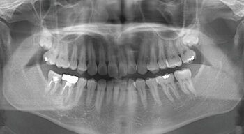 当院の矯正治療の特長 | 倉敷市の歯医者 ふくしま矯正歯科